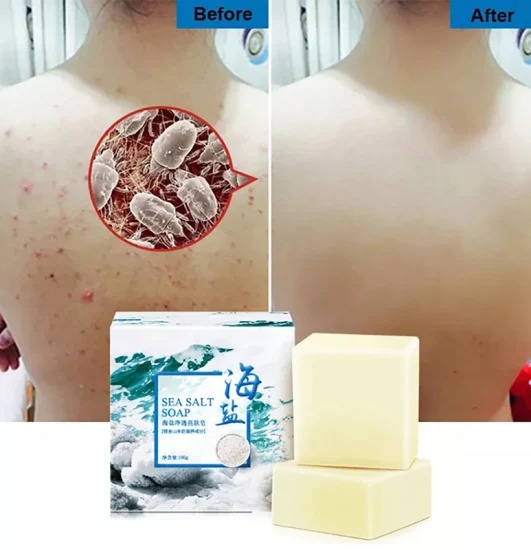 SEA SALT SOAP  Чудо мыло с морской солью, от прыщей и акне