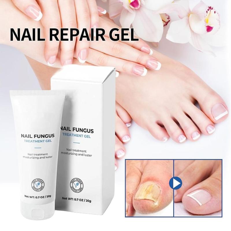 OUHOE Гель для лечения грибка ногтей