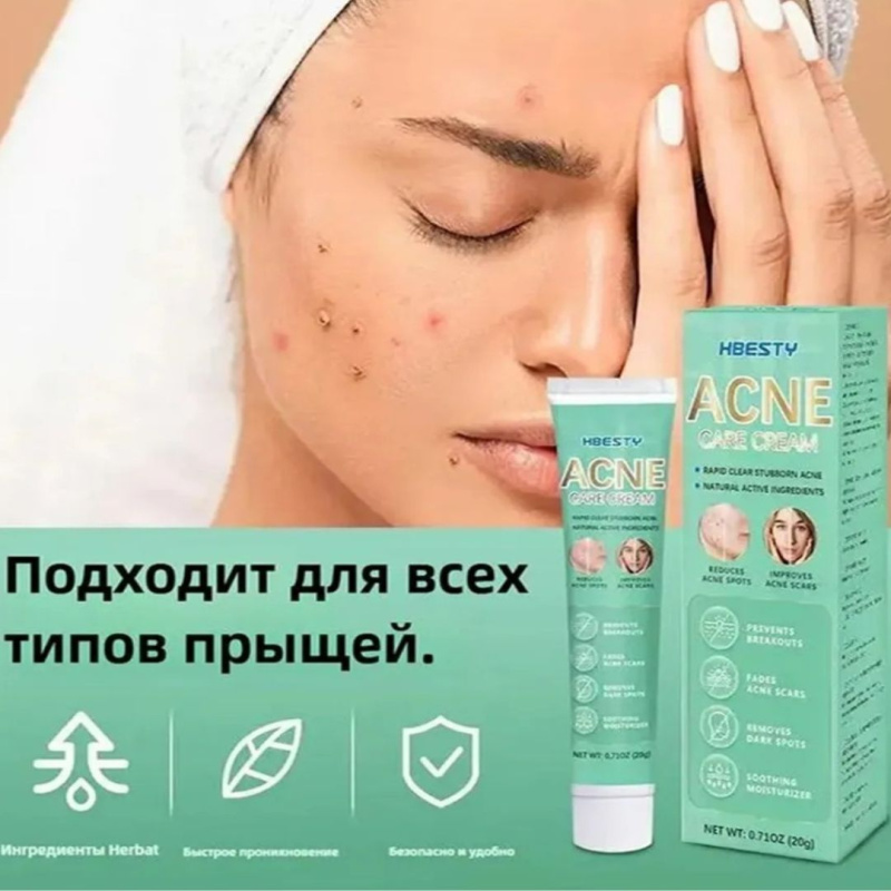 HBESTY Гель для лица, лечение акне и прыщей 20 г