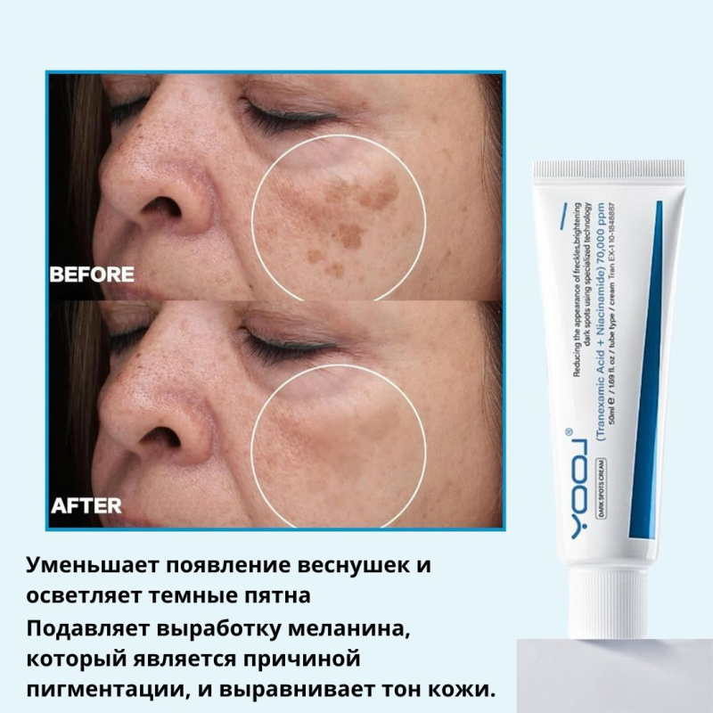YOOJ Крем для лица от пигментных пятен, содержащий ниацинамид и транексамовую кислоту, предназначен для удаления веснушек, гиперпигментации, возрастных пятен, дефектов кожи, мелазмы. 50 мл.