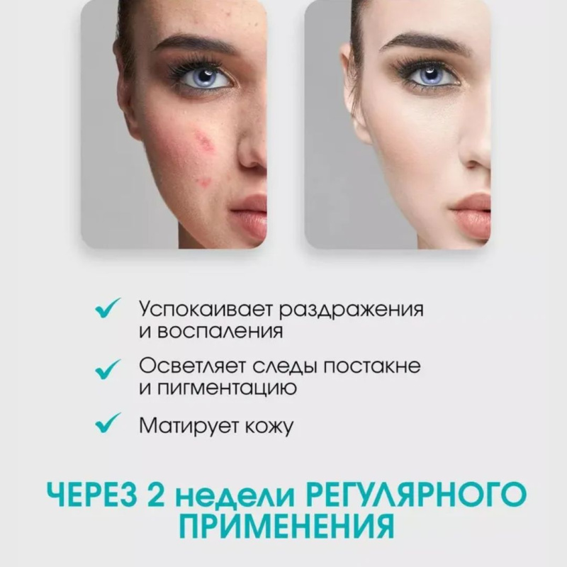 COSRX Гель пенка для умывания pH 5-6 , Low pH Good Morning Gel Cleanser, 150 мл / Корея