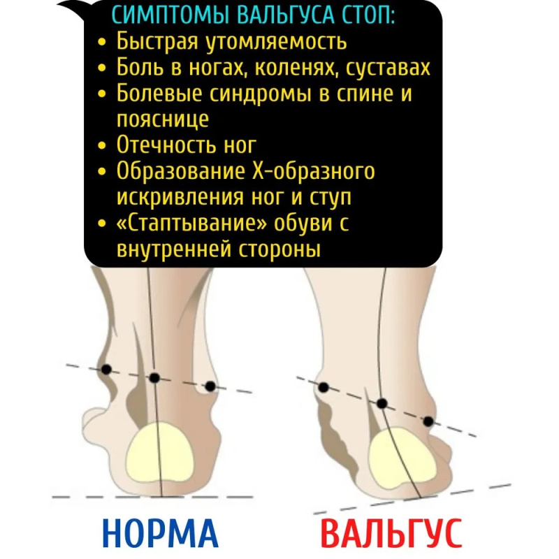 Ортопедические стельки ,размер  31-32