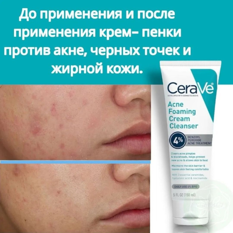 CeraVe Очищающая крем-пенка от прыщей 4% CeraVe Acne Foaming Cream Cleanser 150 мл